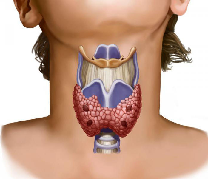 Щитовидная железа МРТ ­