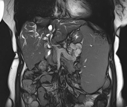 МРТ снимок внутренних органов